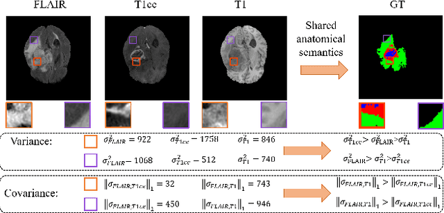 Figure 1 for Anatomical Consistency Distillation and Inconsistency Synthesis for Brain Tumor Segmentation with Missing Modalities