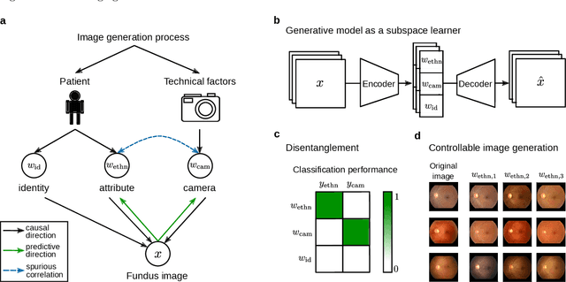 Figure 1 for Disentangling representations of retinal images with generative models