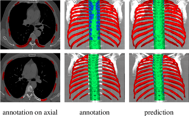 Figure 3 for Hierarchical Loss And Geometric Mask Refinement For Multilabel Ribs Segmentation