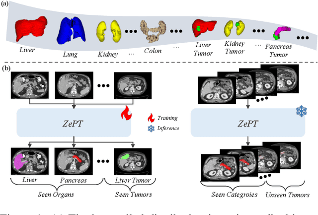 Figure 1 for ZePT: Zero-Shot Pan-Tumor Segmentation via Query-Disentangling and Self-Prompting