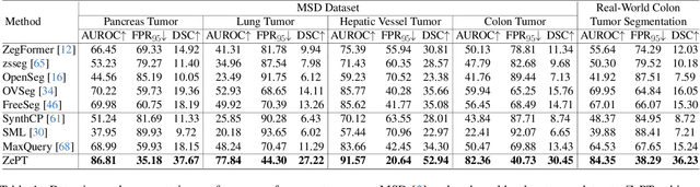 Figure 2 for ZePT: Zero-Shot Pan-Tumor Segmentation via Query-Disentangling and Self-Prompting