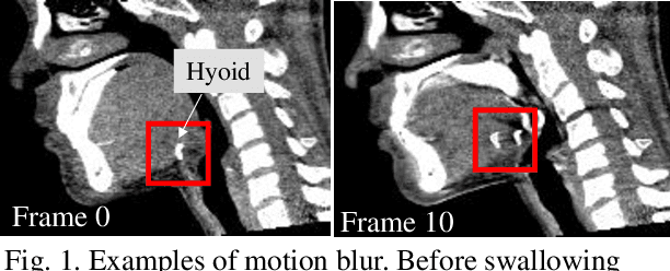 Figure 1 for Visualization of Organ Movements Using Automatic Region Segmentation of Swallowing CT