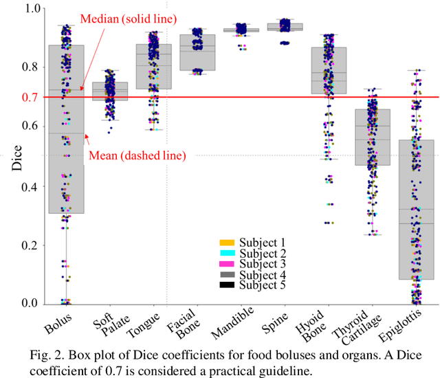 Figure 2 for Visualization of Organ Movements Using Automatic Region Segmentation of Swallowing CT