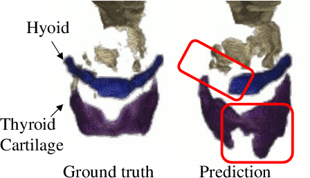 Figure 4 for Visualization of Organ Movements Using Automatic Region Segmentation of Swallowing CT