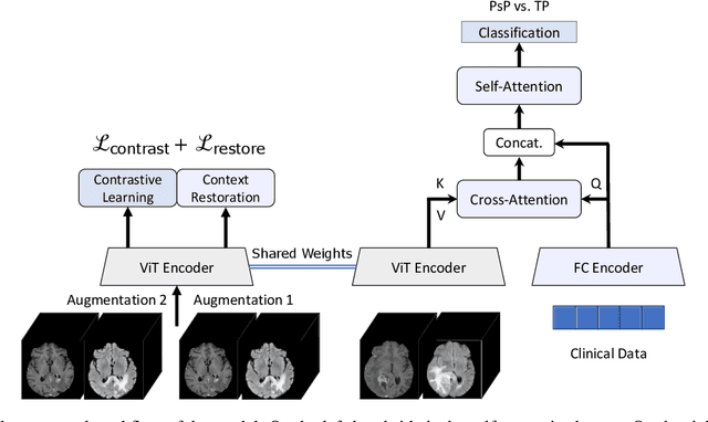 Figure 2 for A Self-supervised Multimodal Deep Learning Approach to Differentiate Post-radiotherapy Progression from Pseudoprogression in Glioblastoma