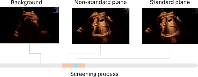 Figure 2 for I saw, I conceived, I concluded: Progressive Concepts as Bottlenecks