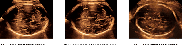 Figure 3 for I saw, I conceived, I concluded: Progressive Concepts as Bottlenecks