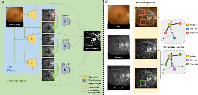 Figure 1 for Fundus2Video: Cross-Modal Angiography Video Generation from Static Fundus Photography with Clinical Knowledge Guidance