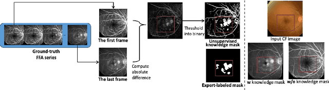 Figure 3 for Fundus2Video: Cross-Modal Angiography Video Generation from Static Fundus Photography with Clinical Knowledge Guidance