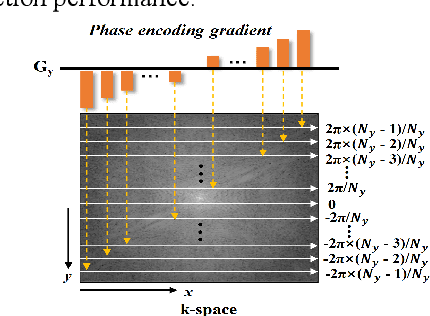 Figure 1 for Encoding Enhanced Complex CNN for Accurate and Highly Accelerated MRI