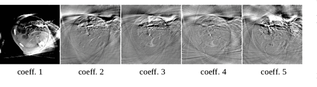 Figure 3 for Liver Segmentation in Time-resolved C-arm CT Volumes Reconstructed from Dynamic Perfusion Scans using Time Separation Technique