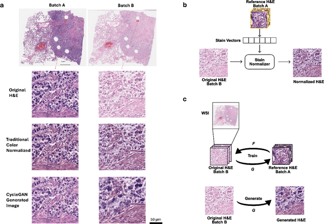 Figure 1 for Impact of Stain Variation and Color Normalization for Prognostic Predictions in Pathology