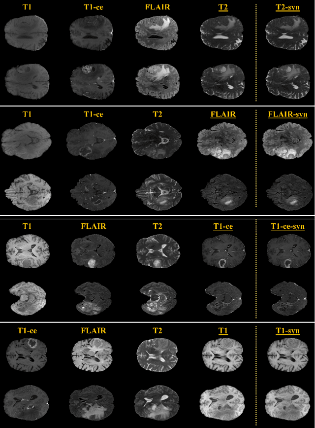 Figure 3 for Multi-modal Contrastive Learning for Tumor-specific Missing Modality Synthesis