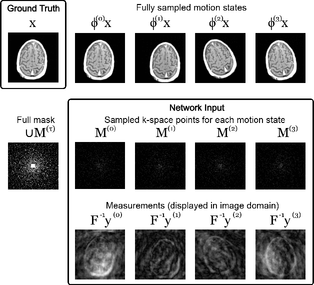 Figure 1 for Non-rigid Motion Correction for MRI Reconstruction via Coarse-To-Fine Diffusion Models