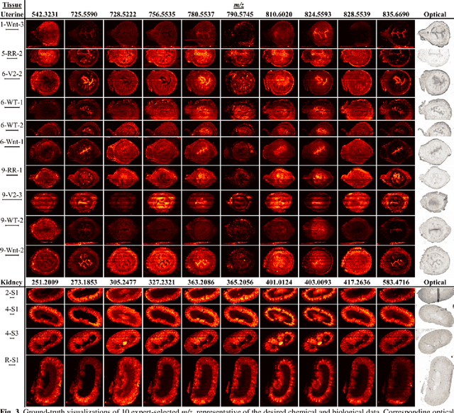 Figure 3 for Deep Learning Approach for Dynamic Sampling for Multichannel Mass Spectrometry Imaging