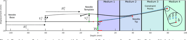 Figure 1 for Bevel-Tip Needle Deflection Modeling, Simulation, and Validation in Multi-Layer Tissues