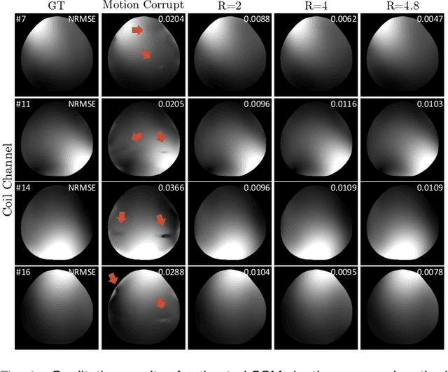 Figure 4 for JSMoCo: Joint Coil Sensitivity and Motion Correction in Parallel MRI with a Self-Calibrating Score-Based Diffusion Model