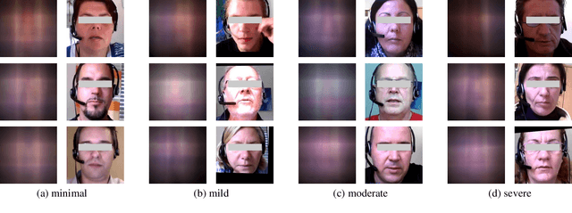 Figure 3 for OpticalDR: A Deep Optical Imaging Model for Privacy-Protective Depression Recognition