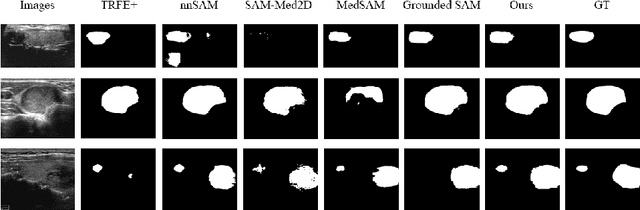 Figure 3 for Curriculum Prompting Foundation Models for Medical Image Segmentation