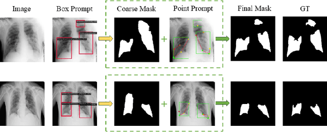 Figure 4 for Curriculum Prompting Foundation Models for Medical Image Segmentation