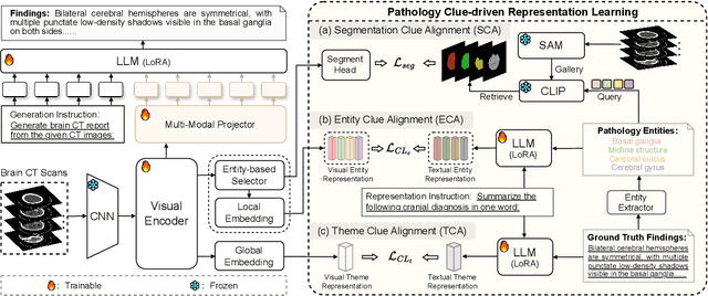 Figure 3 for See Detail Say Clear: Towards Brain CT Report Generation via Pathological Clue-driven Representation Learning