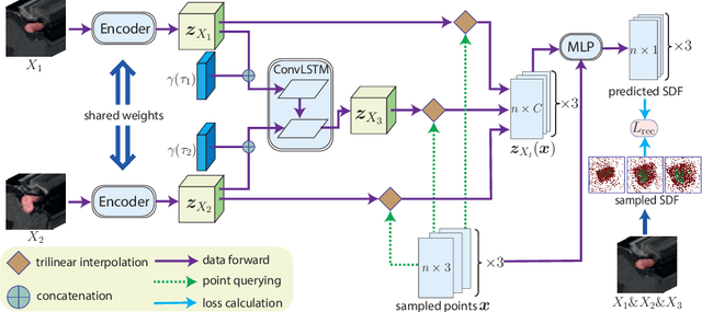 Figure 1 for Vestibular schwannoma growth prediction from longitudinal MRI by time conditioned neural fields