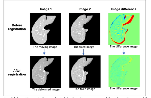 Figure 3 for A comprehensive liver CT landmark pair dataset for evaluating deformable image registration algorithms