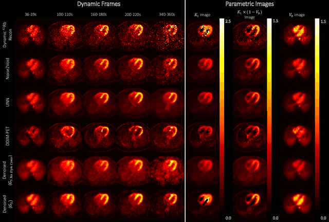 Figure 2 for Noise-aware Dynamic Image Denoising and Positron Range Correction for Rubidium-82 Cardiac PET Imaging via Self-supervision