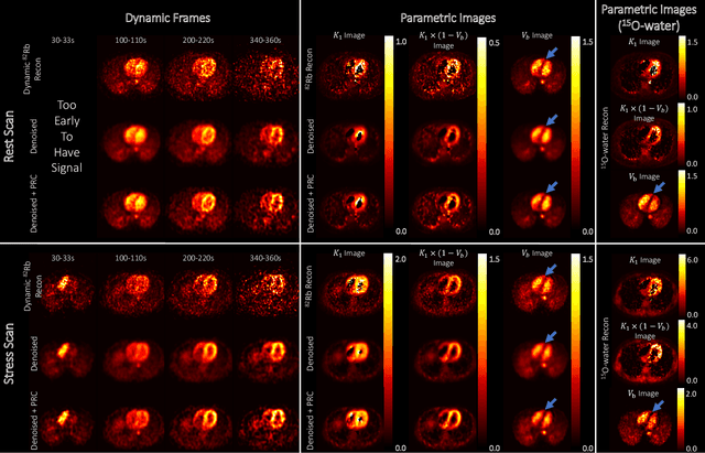 Figure 4 for Noise-aware Dynamic Image Denoising and Positron Range Correction for Rubidium-82 Cardiac PET Imaging via Self-supervision