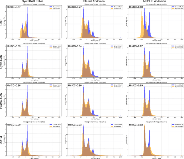 Figure 4 for seg2med: a segmentation-based medical image generation framework using denoising diffusion probabilistic models