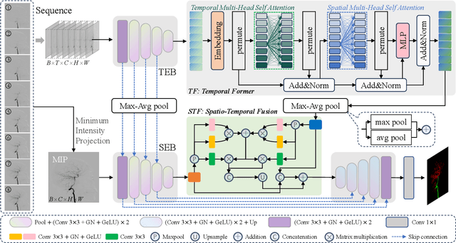 Figure 4 for DSCA: A Digital Subtraction Angiography Sequence Dataset and Spatio-Temporal Model for Cerebral Artery Segmentation