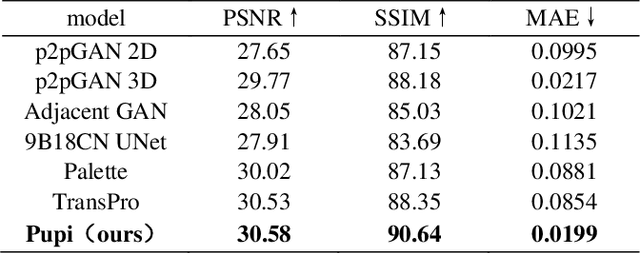 Figure 2 for PupiNet: Seamless OCT-OCTA Interconversion Through Wavelet-Driven and Multi-Scale Attention Mechanisms