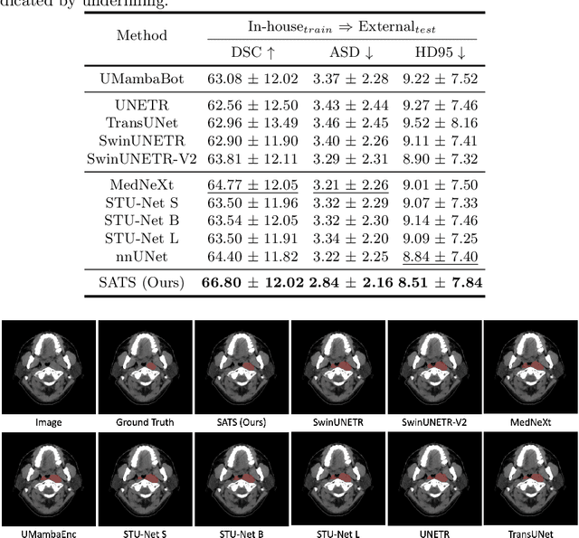 Figure 4 for Leveraging Semantic Asymmetry for Precise Gross Tumor Volume Segmentation of Nasopharyngeal Carcinoma in Planning CT