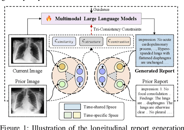 Figure 1 for HC-LLM: Historical-Constrained Large Language Models for Radiology Report Generation