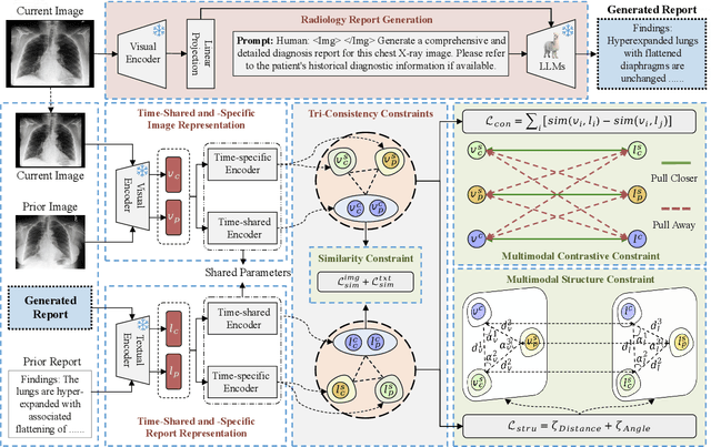 Figure 3 for HC-LLM: Historical-Constrained Large Language Models for Radiology Report Generation