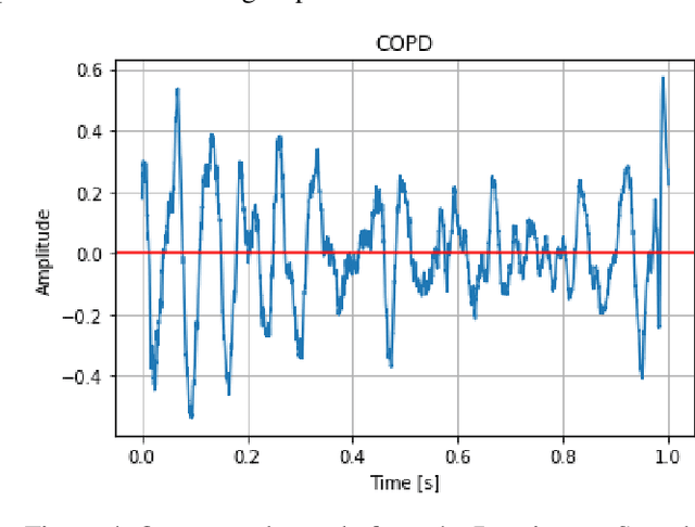 Figure 4 for Respiratory Sound Classification Using Long-Short Term Memory