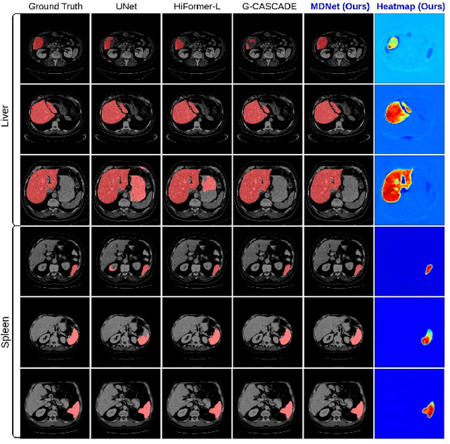 Figure 4 for MDNet: Multi-Decoder Network for Abdominal CT Organs Segmentation