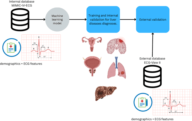 Figure 1 for Explainable machine learning for neoplasms diagnosis via electrocardiograms: an externally validated study