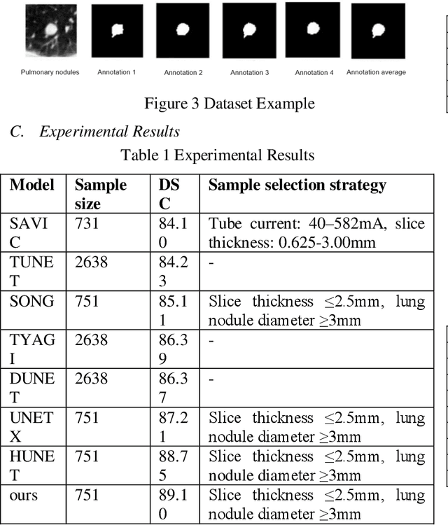 Figure 2 for Deep Learning-Based Channel Squeeze U-Structure for Lung Nodule Detection and Segmentation