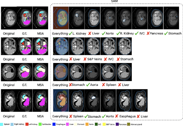 Figure 3 for Medical SAM Adapter: Adapting Segment Anything Model for Medical Image Segmentation