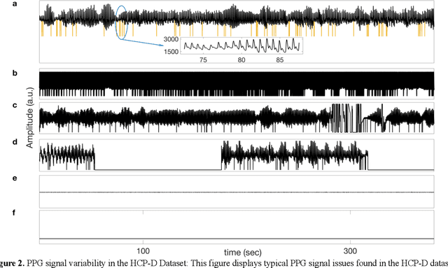 Figure 2 for Direct Estimation of Pediatric Heart Rate Variability from BOLD-fMRI: A Machine Learning Approach Using Dynamic Connectivity