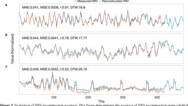 Figure 3 for Direct Estimation of Pediatric Heart Rate Variability from BOLD-fMRI: A Machine Learning Approach Using Dynamic Connectivity