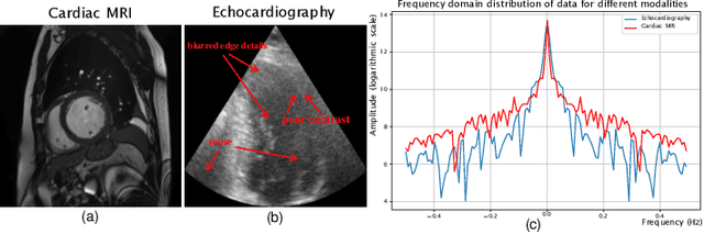 Figure 1 for A Semi-Supervised Approach with Error Reflection for Echocardiography Segmentation