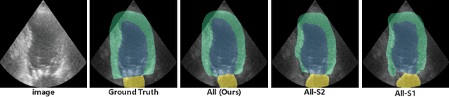 Figure 3 for A Semi-Supervised Approach with Error Reflection for Echocardiography Segmentation