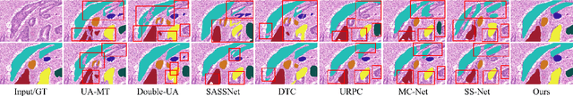 Figure 2 for Affinity-Graph-Guided Contractive Learning for Pretext-Free Medical Image Segmentation with Minimal Annotation