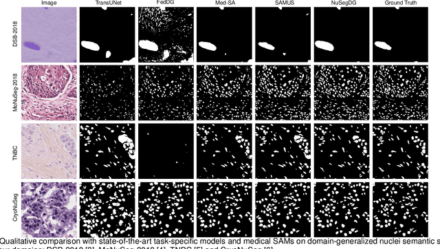 Figure 2 for NuSegDG: Integration of Heterogeneous Space and Gaussian Kernel for Domain-Generalized Nuclei Segmentation