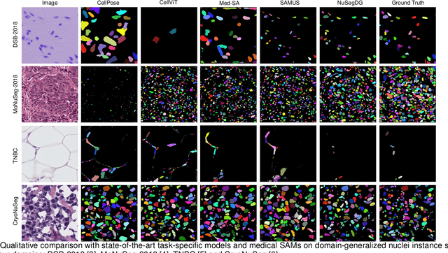 Figure 3 for NuSegDG: Integration of Heterogeneous Space and Gaussian Kernel for Domain-Generalized Nuclei Segmentation