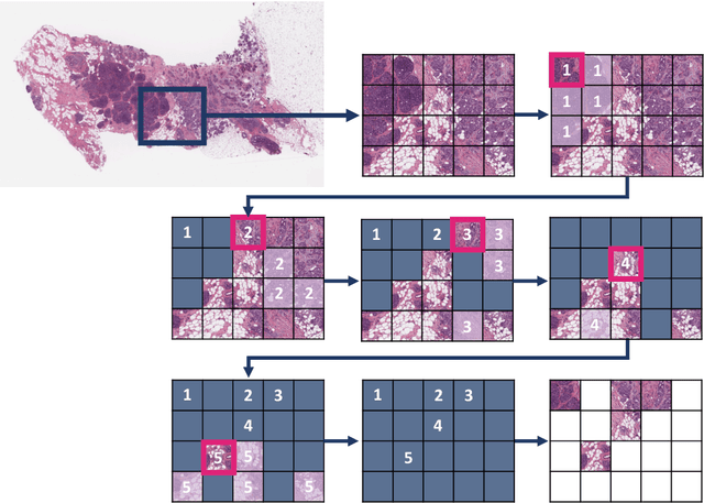 Figure 3 for SPLICE -- Streamlining Digital Pathology Image Processing