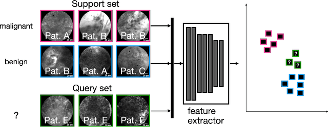 Figure 1 for Few Shot Learning for the Classification of Confocal Laser Endomicroscopy Images of Head and Neck Tumors