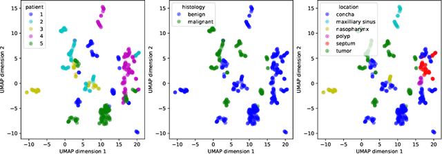 Figure 2 for Few Shot Learning for the Classification of Confocal Laser Endomicroscopy Images of Head and Neck Tumors